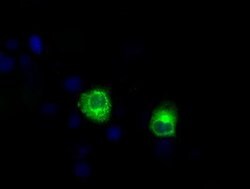 LIPG Mouse anti-Human, Clone: OTI1B8, lyophilized, TrueMAB 100 &mu;g; Unconjugated:Antibodies,