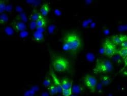 LIPG Monoclonal Antibody (OTI2D5), TrueMAB , OriGene 100 &mu;L; Unconjugated:Antibodies,