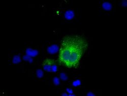 LIPG Mouse anti-Human, Clone: OTI5C3, lyophilized, TrueMAB 100 &mu;g; Unconjugated:Antibodies,