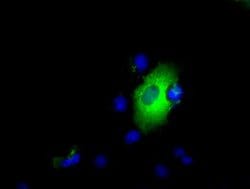 LIPG Mouse anti-Human, Clone: OTI1D9, lyophilized, TrueMAB 100 &mu;g; Unconjugated:Antibodies,