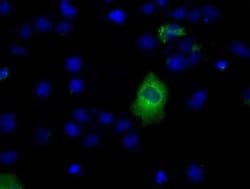 LIPG Monoclonal Antibody (OTI3C7), TrueMAB , OriGene 100 &mu;L; Unconjugated:Antibodies,