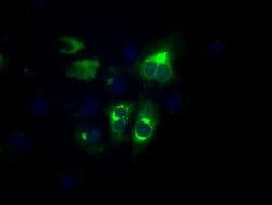 LIPG Monoclonal Antibody (OTI6E11), TrueMAB , OriGene 100 &mu;L; Unconjugated:Antibodies,