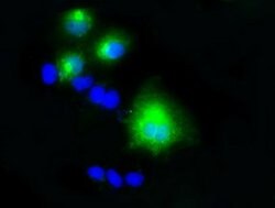 LIPG Mouse anti-Human, Clone: OTI4C3, lyophilized, TrueMAB 100 &mu;g; Unconjugated:Antibodies,