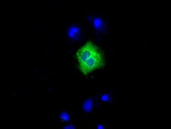 LIPG Monoclonal Antibody (OTI7C2), TrueMAB , OriGene 30 &mu;L; Unconjugated:Antibodies,