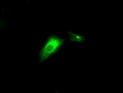 LIPG Mouse anti-Human, Clone: OTI4D2, lyophilized, TrueMAB 100 &mu;g; Unconjugated:Antibodies,