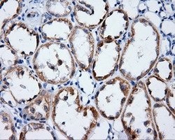 LIPG Monoclonal Antibody (OTI9C5), TrueMAB , OriGene:Antibodies:Primary