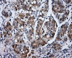 LIPG Monoclonal Antibody (OTI9C5), TrueMAB , OriGene:Antibodies:Primary