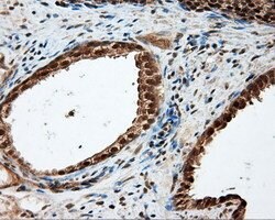 LIPG Monoclonal Antibody (OTI3G7), TrueMAB , OriGene 100 &mu;L; Unconjugated:Antibodies,
