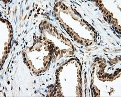 LIPG Monoclonal Antibody (OTI3G7), TrueMAB , OriGene 100 &mu;L; Unconjugated:Antibodies,
