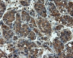 LIPG Monoclonal Antibody (OTI3G7), TrueMAB , OriGene 100 &mu;L; Unconjugated:Antibodies,