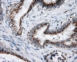 LIPG Monoclonal Antibody (OTI2H10), TrueMAB , OriGene 100 &mu;L; Unconjugated:Antibodies,
