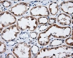 LIPG Mouse anti-Human, Clone: OTI1B8, lyophilized, TrueMAB 100 &mu;g; Unconjugated:Antibodies,
