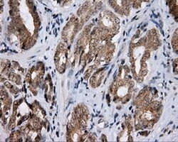 LIPG Monoclonal Antibody (OTI2D5), TrueMAB , OriGene 100 &mu;L; Unconjugated:Antibodies,