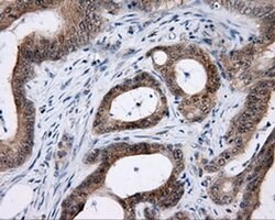LIPG Monoclonal Antibody (OTI2D5), TrueMAB , OriGene 100 &mu;L; Unconjugated:Antibodies,