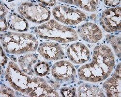 LIPG Mouse anti-Human, Clone: OTI5C3, lyophilized, TrueMAB 100 &mu;g; Unconjugated:Antibodies,