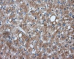 LIPG Mouse anti-Human, Clone: OTI5C3, lyophilized, TrueMAB 100 &mu;g; Unconjugated:Antibodies,