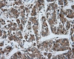 LIPG Mouse anti-Human, Clone: OTI5C3, lyophilized, TrueMAB 100 &mu;g; Unconjugated:Antibodies,