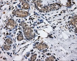 LIPG Mouse anti-Human, Clone: OTI1D9, lyophilized, TrueMAB 100 &mu;g; Unconjugated:Antibodies,