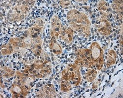 LIPG Mouse anti-Human, Clone: OTI1D9, lyophilized, TrueMAB 100 &mu;g; Unconjugated:Antibodies,