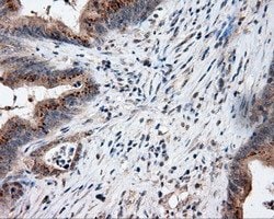 LIPG Mouse anti-Human, Clone: OTI1D9, lyophilized, TrueMAB 100 &mu;g; Unconjugated:Antibodies,