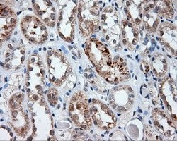 LIPG Mouse anti-Human, Clone: OTI1D9, lyophilized, TrueMAB 100 &mu;g; Unconjugated:Antibodies,