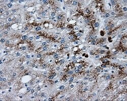 LIPG Mouse anti-Human, Clone: OTI1D9, lyophilized, TrueMAB 100 &mu;g; Unconjugated:Antibodies,