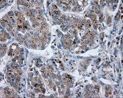 LIPG Mouse anti-Human, Clone: OTI1D9, lyophilized, TrueMAB 100 &mu;g; Unconjugated:Antibodies,