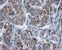 LIPG Monoclonal Antibody (OTI1D9), TrueMAB , OriGene 30 &mu;L; Unconjugated:Anticuerpos