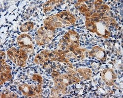 LIPG Monoclonal Antibody (OTI3C7), TrueMAB , OriGene 100 &mu;L; Unconjugated:Antibodies,
