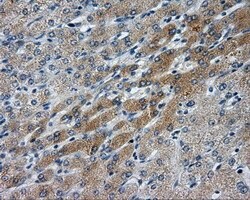 LIPG Monoclonal Antibody (OTI3C7), TrueMAB , OriGene 100 &mu;L; Unconjugated:Antibodies,