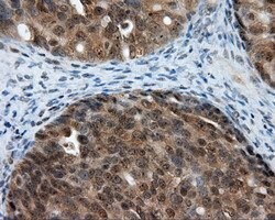 LIPG Monoclonal Antibody (OTI6E11), TrueMAB , OriGene 100 &mu;L; Unconjugated:Antibodies,