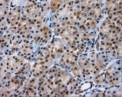 LIPG Monoclonal Antibody (OTI6E11), TrueMAB , OriGene 100 &mu;L; Unconjugated:Antibodies,