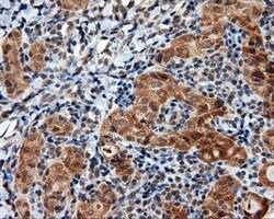 LIPG Monoclonal Antibody (OTI6E11), TrueMAB , OriGene 100 &mu;L; Unconjugated:Antibodies,