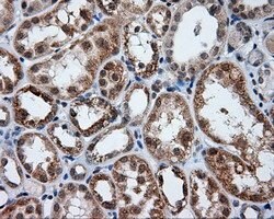 LIPG Monoclonal Antibody (OTI6E11), TrueMAB , OriGene 100 &mu;L; Unconjugated:Antibodies,