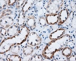 LIPG Mouse anti-Human, Clone: OTI4C3, lyophilized, TrueMAB 100 &mu;g; Unconjugated:Antibodies,