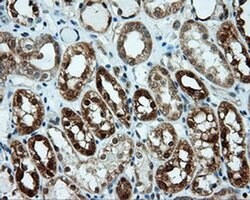 LIPG Monoclonal Antibody (OTI7C2), TrueMAB , OriGene:Antibodies:Primary