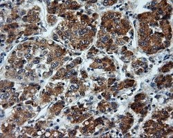 LIPG Monoclonal Antibody (OTI7C2), TrueMAB , OriGene 30 &mu;L; Unconjugated:Antibodies,