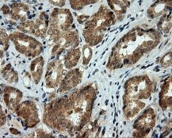 LIPG Mouse anti-Human, Clone: OTI8F8, lyophilized, TrueMAB 100 &mu;g; Unconjugated:Antibodies,