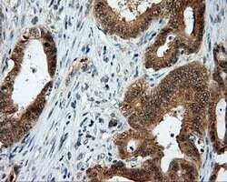 LIPG Mouse anti-Human, Clone: OTI8F8, lyophilized, TrueMAB 100 &mu;g; Unconjugated:Antibodies,