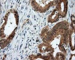 LIPG Monoclonal Antibody (OTI8F8), TrueMAB , OriGene 100 &mu;L; Unconjugated:Antibodies,
