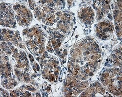 LIPG Mouse anti-Human, Clone: OTI8F8, lyophilized, TrueMAB 100 &mu;g; Unconjugated:Antibodies,