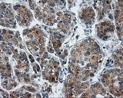 LIPG Monoclonal Antibody (OTI8F8), TrueMAB , OriGene 100 &mu;L; Unconjugated:Antibodies,