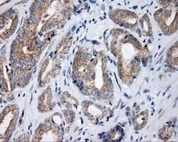 LIPG Monoclonal Antibody (OTI3C4), TrueMAB , OriGene 100 &mu;L; Unconjugated:Antibodies,