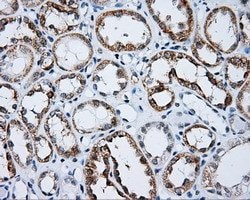 LIPG Monoclonal Antibody (OTI6B11), TrueMAB , OriGene 100 &mu;L; Unconjugated:Anticuerpos