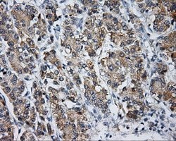 LIPG Monoclonal Antibody (OTI6B11), TrueMAB , OriGene 100 &mu;L; Unconjugated:Anticuerpos