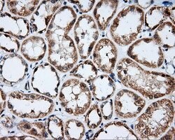 LIPG Mouse anti-Human, Clone: OTI4D2, lyophilized, TrueMAB 100 &mu;g; Unconjugated:Antibodies,