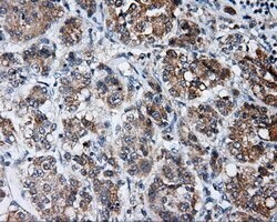 LIPG Mouse anti-Human, Clone: OTI4D2, lyophilized, TrueMAB 100 &mu;g; Unconjugated:Antibodies,