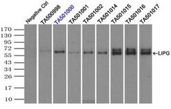 LIPG Monoclonal Antibody (OTI3G7), TrueMAB , OriGene 100 &mu;L; Unconjugated:Antibodies,