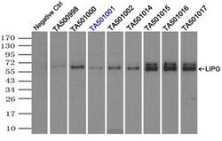 LIPG Monoclonal Antibody (OTI2H10), TrueMAB , OriGene 100 &mu;L; Unconjugated:Antibodies,