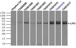 LIPG Monoclonal Antibody (OTI1D9), TrueMAB , OriGene 30 &mu;L; Unconjugated:Anticuerpos